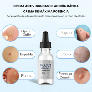 WART REMOVER
