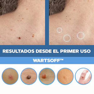 WART-QUITA VERRUGAS
